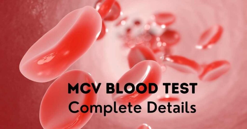 MCV blood test importance, purpose, high, low , factors