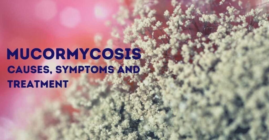 mucormycosis-black-fungus-symptoms-causes-treatment