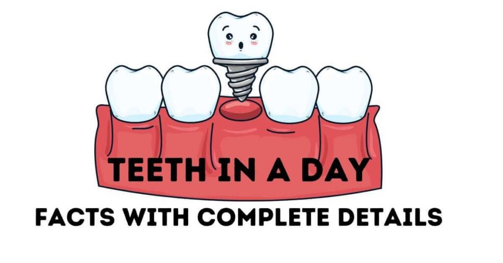 teeth-in-a-day