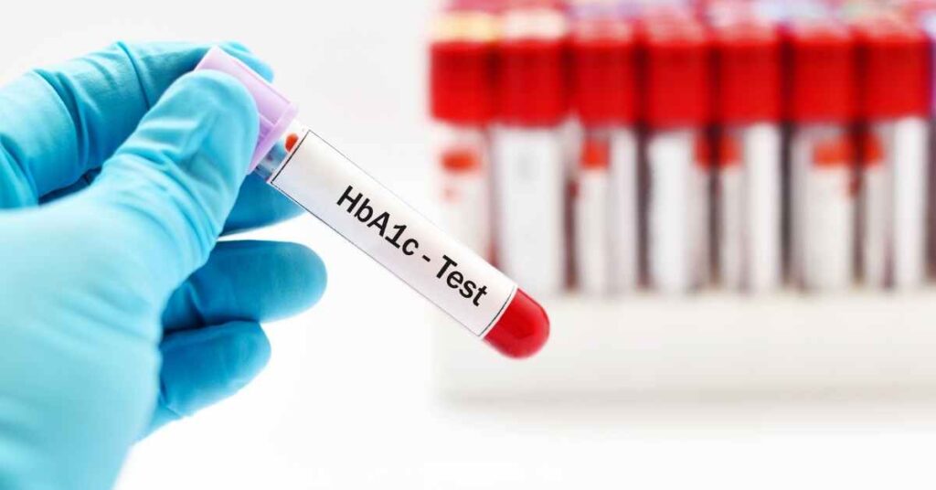 HbA1c test – DoctorOnHealth