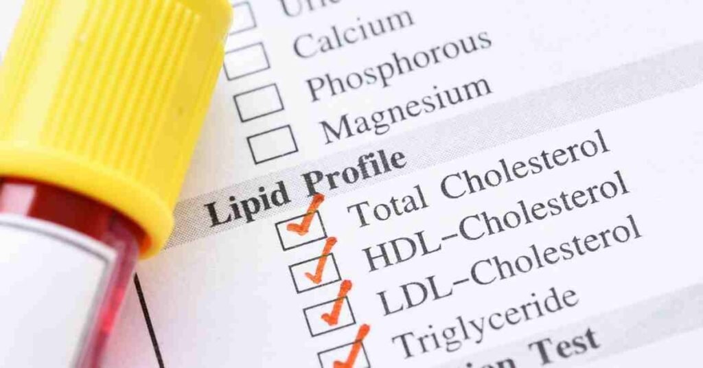 lipid-profile-test-know-details