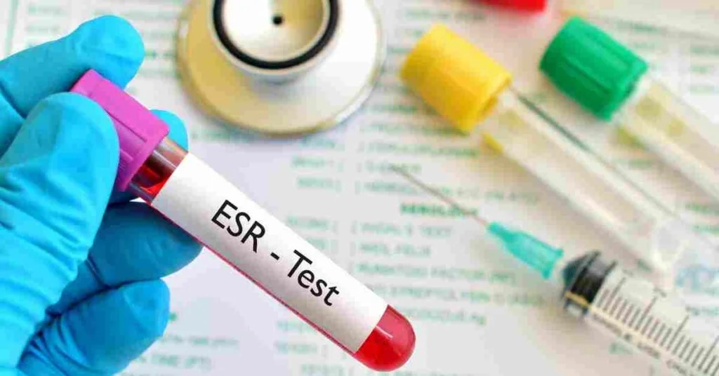 esr-test-complete-details