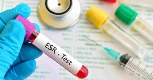 esr-test-complete-details