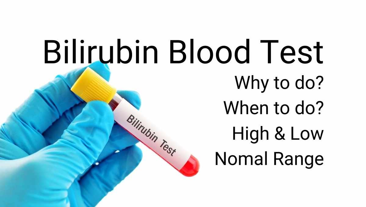 Bilirubin Test – DoctorOnHealth