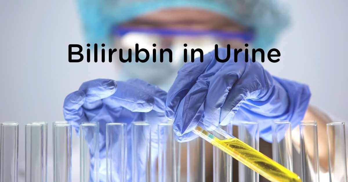 All About Bilirubin in Urine